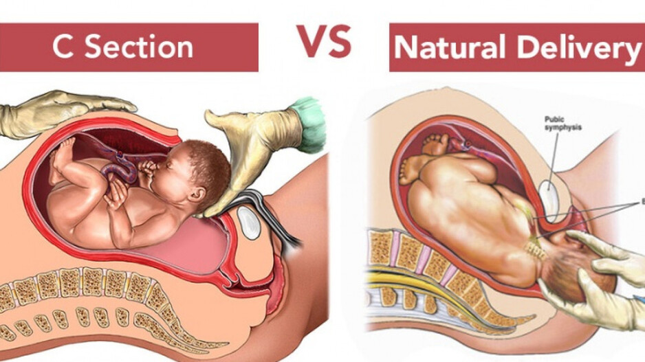  Maternity Surgery