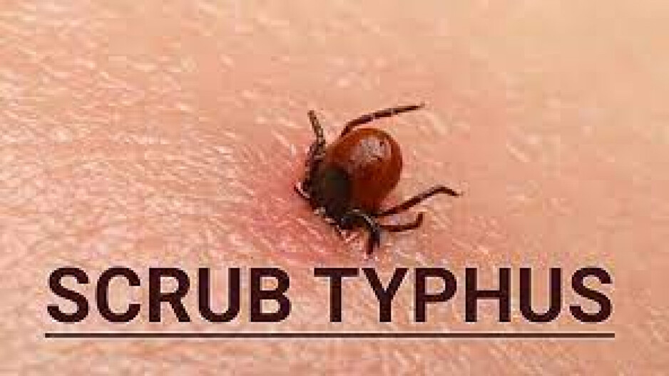 scrub typhus