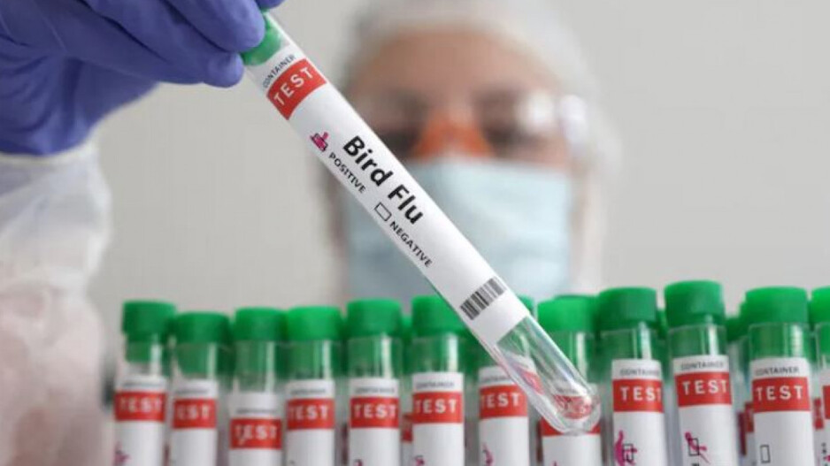 Bird Flu Test 