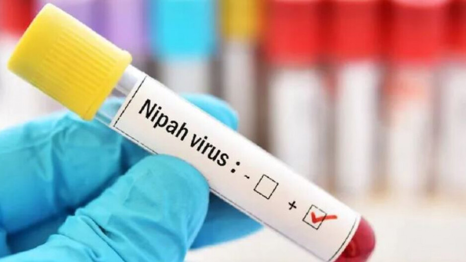 Nipah testing kit 