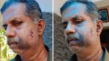 ୪ର୍ଥ ଶ୍ରେଣୀରେ ହୋଇଥିଲା ଝଗଡ଼ା, ଏବେ ୬୨ ବର୍ଷୀୟ ବ୍ୟକ୍ତିଙ୍କୁ କଲେ ଲହୁ ଲୁହାଣ
