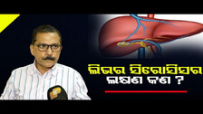 ଲିଭର ସିରୋସିସ୍‌ ର ଲକ୍ଷଣ କଣ ? || Symptoms Of Liver Cirrhosis || Odisha Reporter