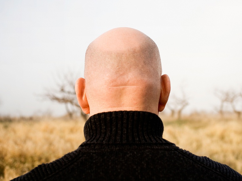 bald-head-alamy 123