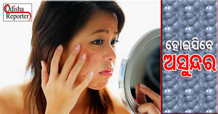 acne problems copy
