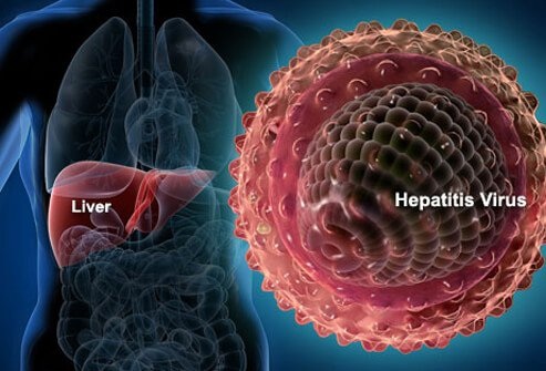hepatitis-s1-liver-hepatitis-virus